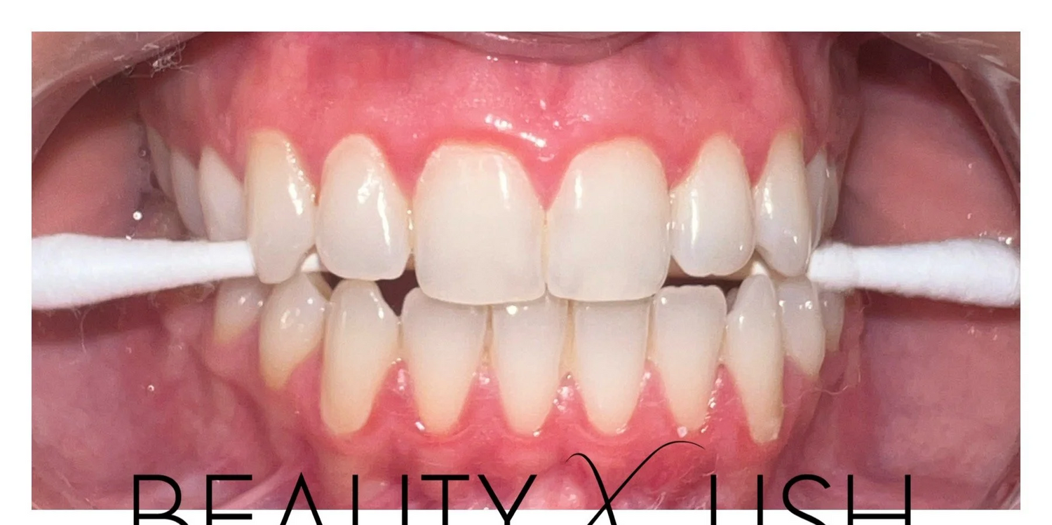 image comparison before